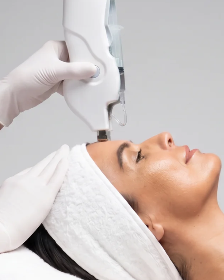 Mesotherapy Gun Behandlung: Kundin liegt entspannt, die Toskani Mesojet Gun wird an der Stirn angesetzt, bei FlashLine & Beauty in Waidhofen/Ybbs