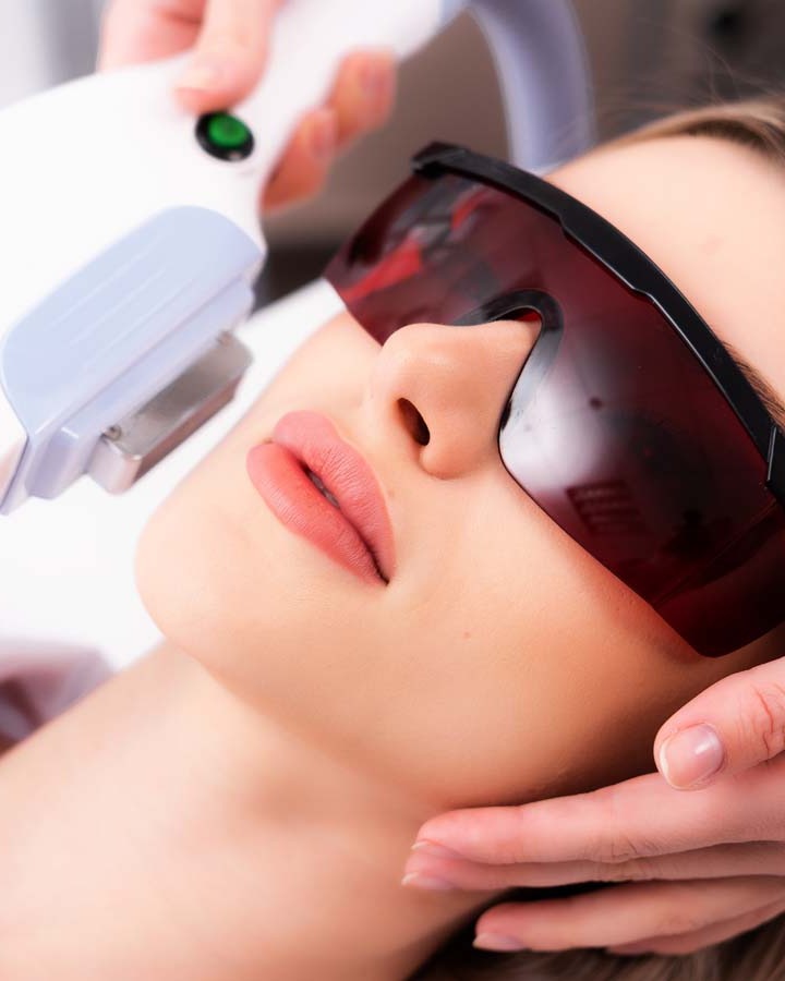 IPL Gesichtsbehandlung: Lichtapplikator an der Wange einer Kundin mit Schutzbrille bei FlashLine & Beauty in Waidhofen/Ybbs