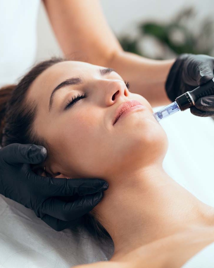 Juliette Armand AMESON Behandlung: Wirkstoffauftrag per Needling-Stift bei FlashLine & Beauty in Waidhofen/Ybbs