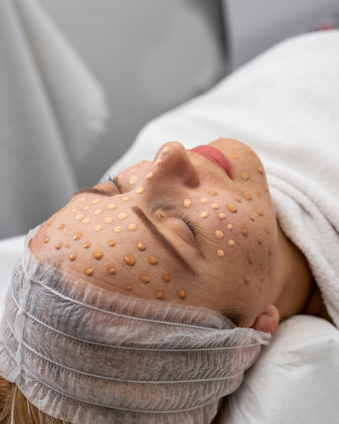 BB Glow Signature Behandlung: punktuell aufgetragene Farbpigmente im Gesicht bei FlashLine & Beauty in Waidhofen/Ybbs